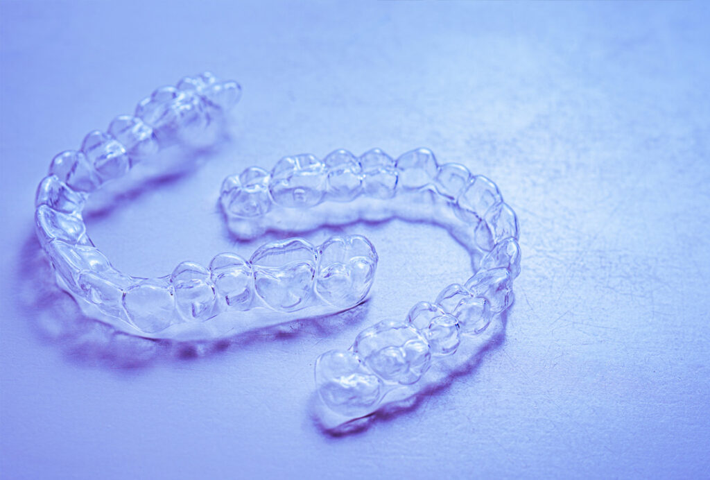 aligner trasparenti